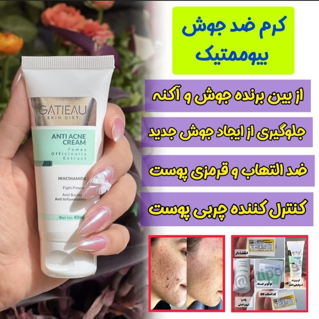کرم بیوممتیک ضد جوش اصلی