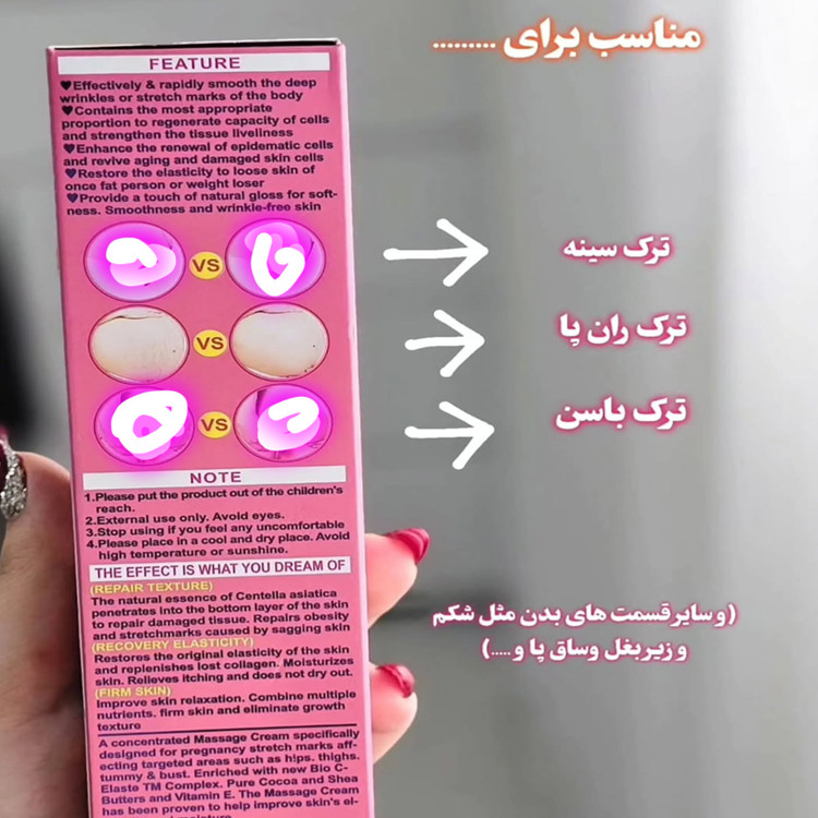 کرم رفع ترک بدن ووکالی اصلی